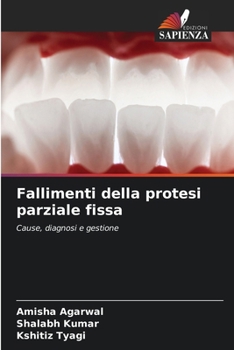 Fallimenti della protesi parziale fissa (Italian Edition)