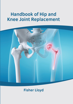 Hardcover Handbook of Hip and Knee Joint Replacement Book