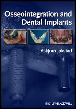 Hardcover Osseointegration and Dental Implants Book