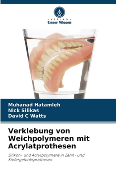 Paperback Verklebung von Weichpolymeren mit Acrylatprothesen [German] Book