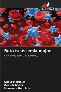 Beta talassemia major