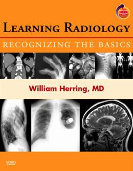 Paperback Learning Radiology: Recognizing the Basics (with Student Consult Online Access) Book