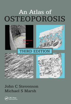 Paperback An Atlas of Osteoporosis Book