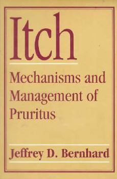 Paperback Itch: Mechanisms and Management of Pruritus Book