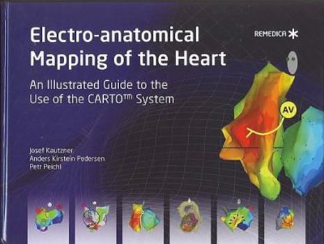 Hardcover Electro-anatomical Mapping of the Heart: An Illustrated Guide to the Use of the Carto System Book