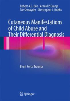 Hardcover Cutaneous Manifestations of Child Abuse and Their Differential Diagnosis: Blunt Force Trauma Book