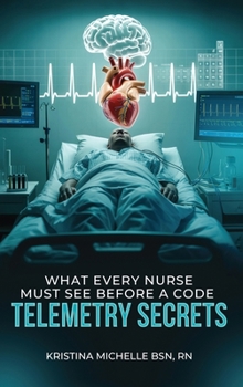 What Every Nurse Must See Before a Code: Telemetry Secrets