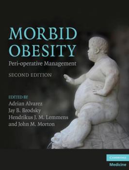 Hardcover Morbid Obesity: Peri-Operative Management Book