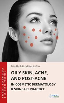 Oily Skin, Acne, and Post-Acne in Cosmetic Dermatology & Skincare Practice