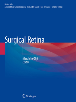 Paperback Surgical Retina Book