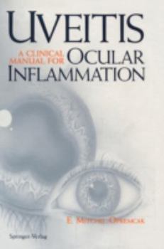 Hardcover Uveitis: A Clinical Manual for Ocular Inflammation Book