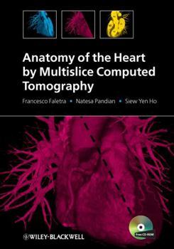 Hardcover Anatomy of the Heart by Multislice Computed Tomography [With CDROM] Book