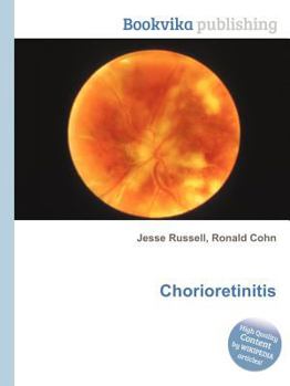 Paperback Chorioretinitis Book
