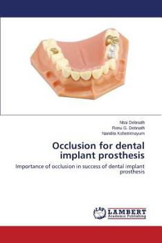 Paperback Occlusion for Dental Implant Prosthesis Book