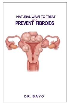 Paperback Natural Ways to Treat and Prevent Fibroids Book
