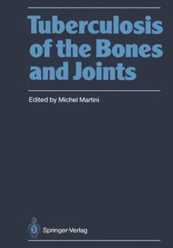 Paperback Tuberculosis of the Bones and Joints Book
