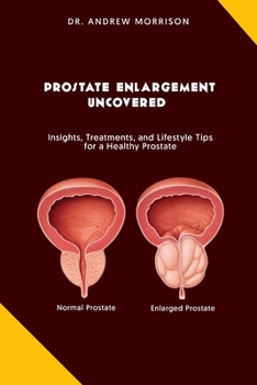 Prostrate Enlargement Uncovered: Insights, Treatments, and Lifestyle Tips for a Healthy Prostate