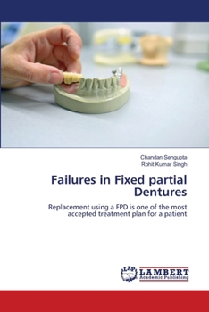 Paperback Failures in Fixed partial Dentures Book