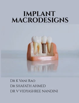 Paperback Implant Macrodesigns Book