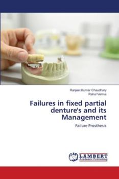 Paperback Failures in fixed partial denture's and its Management Book