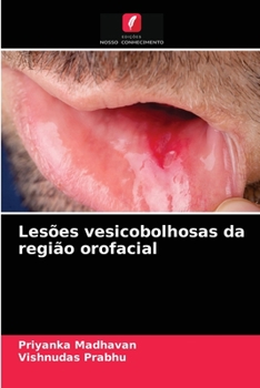 Paperback Lesões vesicobolhosas da região orofacial [Portuguese] Book