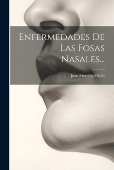 Paperback Enfermedades De Las Fosas Nasales... [Spanish] Book