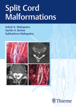 Hardcover Split Cord Malformations Book