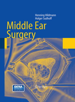 Paperback Middle Ear Surgery Book
