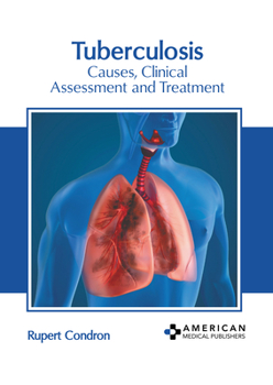 Hardcover Tuberculosis: Causes, Clinical Assessment and Treatment Book