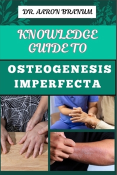 KNOWLEDGE GUIDE TO OSTEOGENESIS IMPERFECTA: Essential Manual To Understanding The Fragile Bone Condition, Diagnosis, Treatment Options, Genetic Insights, And Living With OI