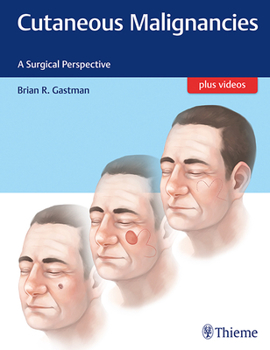 Hardcover Cutaneous Malignancies: A Surgical Perspective Book