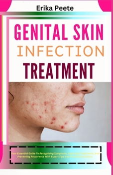 Paperback Genital Skin Infection Treatment: Your Essential Guide To Recognizing Symptoms, Exploring Treatments, And Preventing Recurrence With Expert Tips And P Book