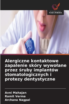 Alergiczne kontaktowe zapalenie skóry wywolane przez sruby implantów stomatologicznych i protezy dentystyczne (Polish Edition)