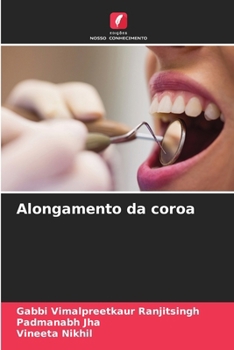 Paperback Alongamento da coroa [Portuguese] Book
