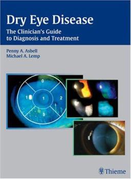 Hardcover Dry Eye Disease: The Clinician's Guide to Diagnosis and Treatment Book