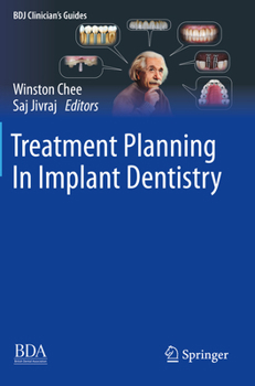 Paperback Treatment Planning in Implant Dentistry Book