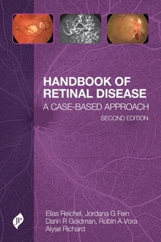 Paperback Handbook of Retinal Disease: A Cased-Based Approach Book