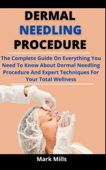 Paperback Dermal Needling Procedure: The Complete Guide On Everything You Need To Know About Dermal Needling Procedure And Expert Techniques For Your Total Book