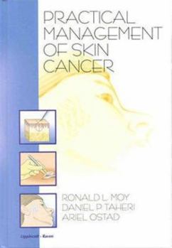 Hardcover Practical Management of Skin Cancer Book