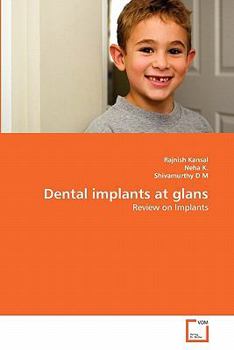 Paperback Dental implants at glans Book