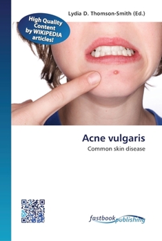 Paperback Acne vulgaris Book