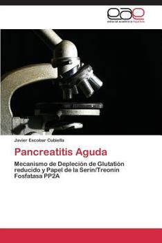 Paperback Pancreatitis Aguda [Spanish] Book