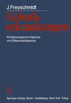 Paperback Gelenkerkrankungen: Röntgenologische Diagnose Und Differentialdiagnose [German] Book