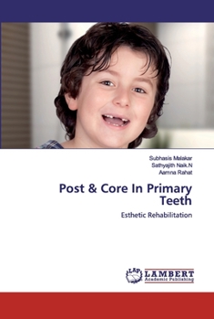 Paperback Post & Core In Primary Teeth Book