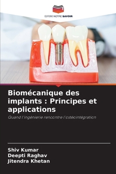 Biomécanique des implants: Principes et applications (French Edition)