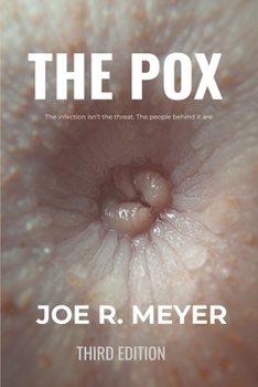The Pox