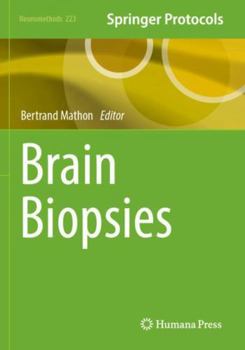 Paperback Brain Biopsies (Neuromethods) Book
