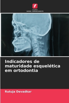 Paperback Indicadores de maturidade esquelética em ortodontia [Portuguese] Book