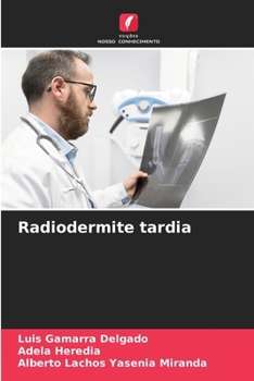 Paperback Radiodermite tardia [Portuguese] Book