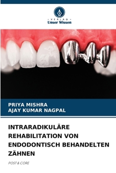 INTRARADIKULÄRE REHABILITATION VON ENDODONTISCH BEHANDELTEN ZÄHNEN: POST & CORE